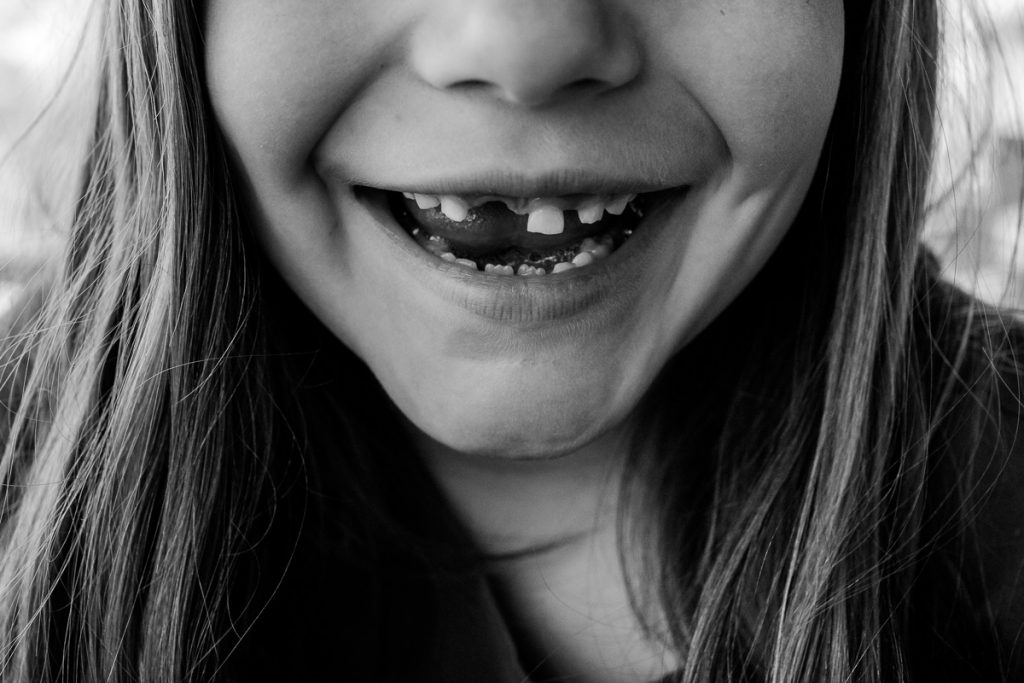 Girl smiling and showing off missing teeth